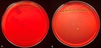 MALDI-TOF MS Biomarker Detection Models to Distinguish RTX Toxin Phenotypes of Moraxella bovoculi Strains Are Enhanced Using Calcium Chloride Supplemented Agar